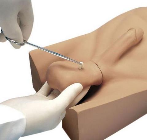 日喀则“康为医疗”新型输精管切除术（NSV）训练操作模型