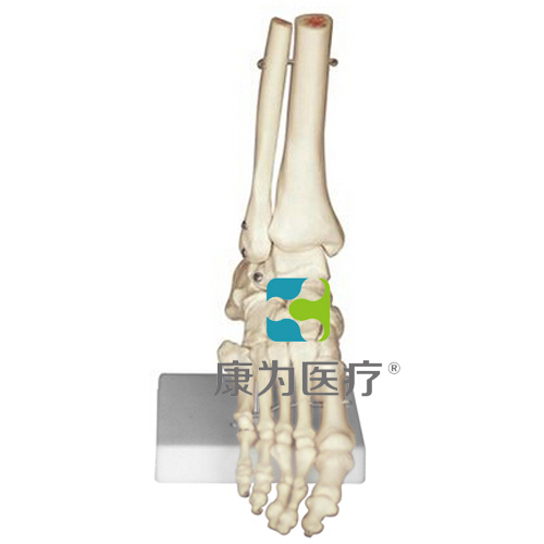 克拉玛依“康为医疗”足骨模型