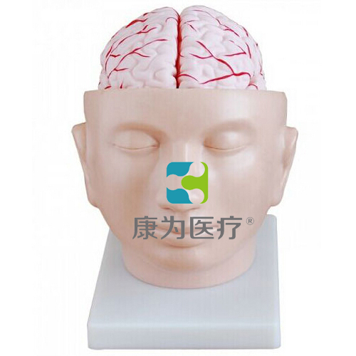 克拉玛依“康为医疗”头部附脑动脉模型