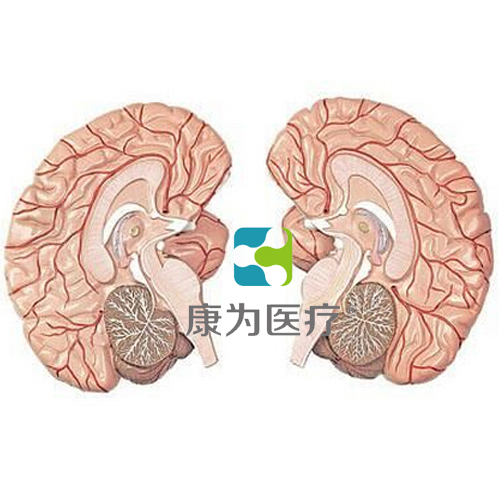 克拉玛依“康为医疗”左右脑带脑动脉分布模型　2部件