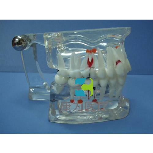 “康为医疗”综合病理水晶牙列模型(28颗牙)