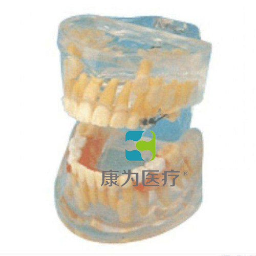 锡林郭勒盟“康为医疗”透明乳牙发育模型