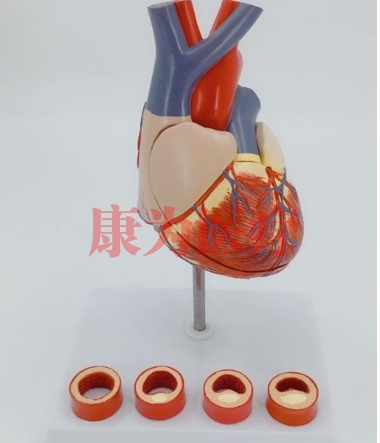 “康为医疗”病态血管心脏演示模型