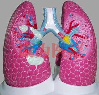 “康为医疗”吸烟者病理肺模型