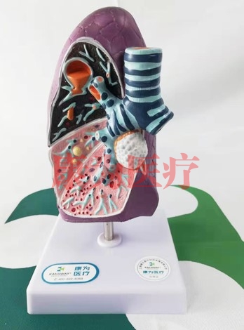 “康为医疗”人体肺部病理模型