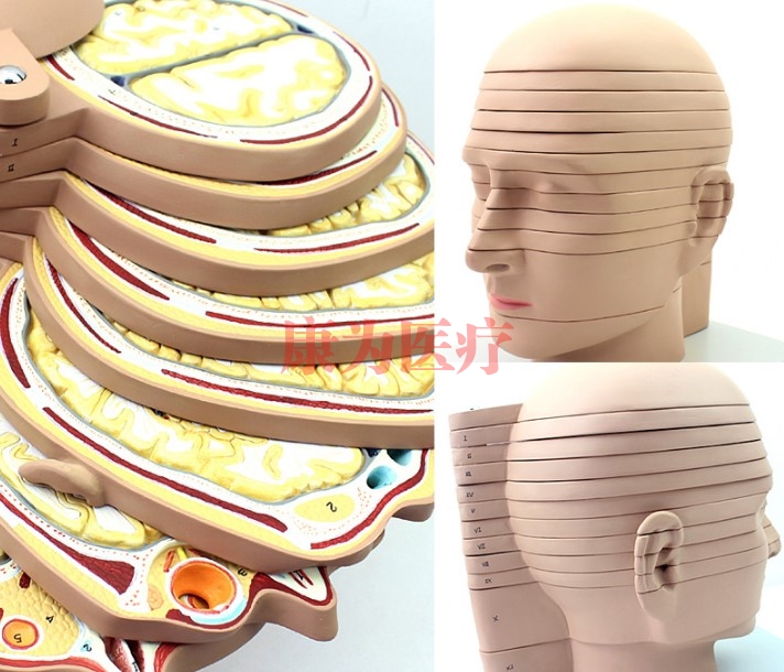 “康为医疗”头颈部切面附脑模型