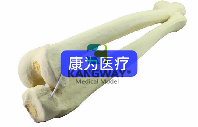 骨科术前Sawbone人工合成骨模型股骨胫骨模型
